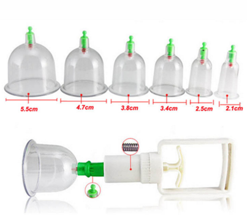 Medical Body Cupping Glass Set